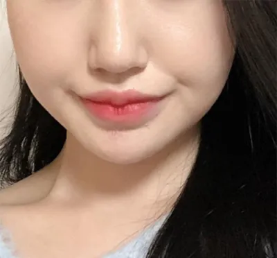 [Арьс] Жижижижижижи - Шринк, Контур Токсин