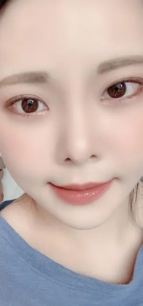 [Нүд] songi1938 - Арын болон доод зовхины тайралт