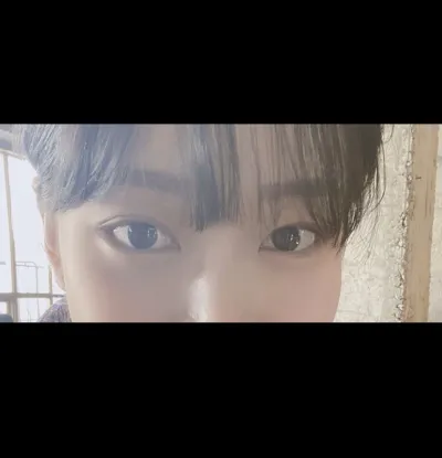 [Нүд] yong0423 - Ар, доод зовхины тайралт