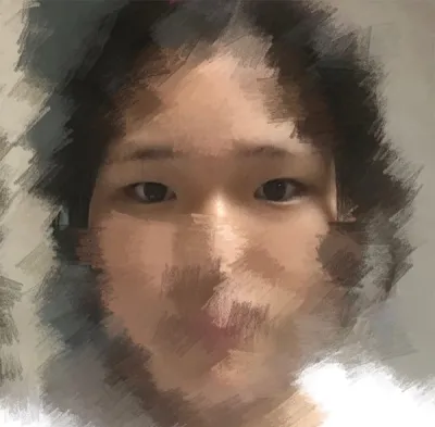 [Нүд] Jung Ye-seul - Урд зүсэлт, Нүдний хэлбэр засах