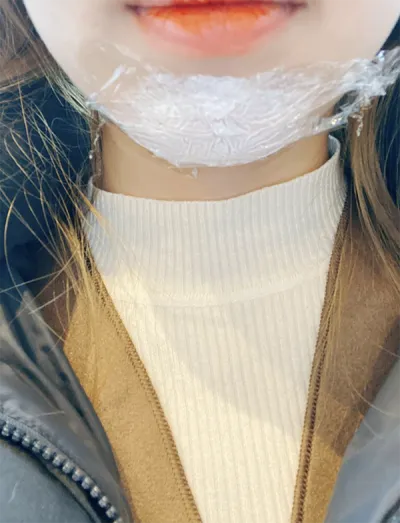 [Жижиг] Бөкчүнаапопхо - Эрүүний контур дүүргэгч, Ботокс