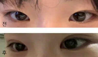 [Нүд] Чоки1234 - Нүд