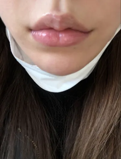 [Бяцхан] vvkim - Филлер