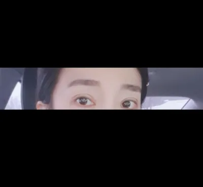 [Нүд] Хагас Бархас - Нүдний Давтан Мэс Засал