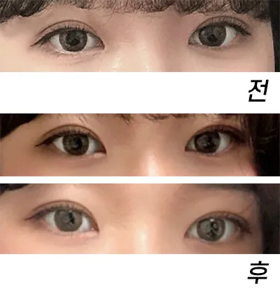 [Нүд] qhrehd - Нүд