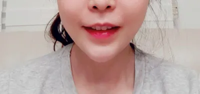 [Арьс] gus0311 - Филлер, Лифтинг