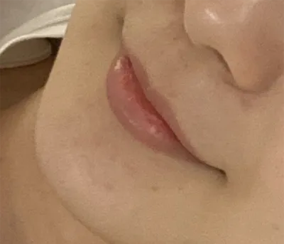 [Бяцхан] Үүлэн үүл 2 - Уруул