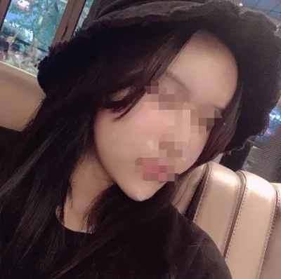 [Анти-Эйджинг] 강남좋아 - Өөх шилжүүлэн суулгах