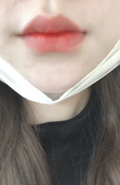 [Жижиг] Лилигал - Уруулын филлер