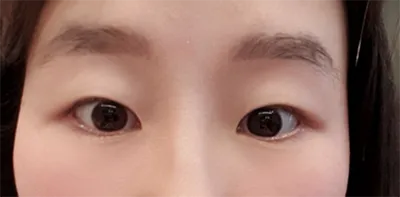 [Нүд] Мегалодон - Нүд