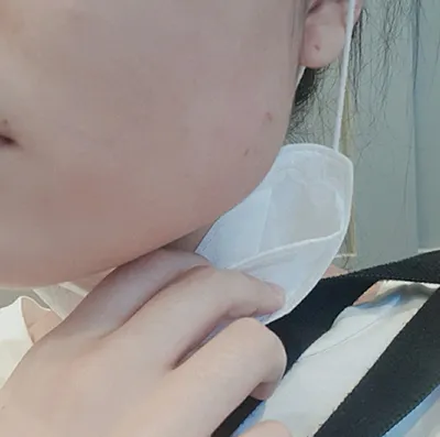 [Бяцхан] Сөүл - эрүүний ботокс