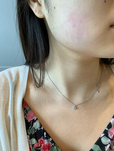 [Арьс] Cafe au lait - Ultherapy Lifting