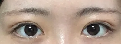 [Нүд] Kwon Dong-ha - Нүд