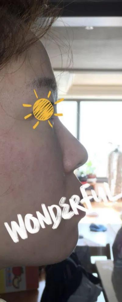 [Хамрын] Shee288 - Хамрын нуруу, хамрын үзүүр