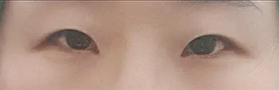 [Нүд] Пингүжин - Нүд