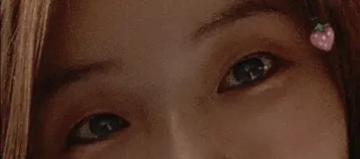 [Нүд] Хававахаха - Нүдний хэлбэр засах, зүсэлт