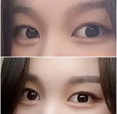 [Нүд] Ёндуду - Давхраа, Зүслэг