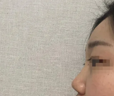 [Нүд] wlswn1 - Хамар