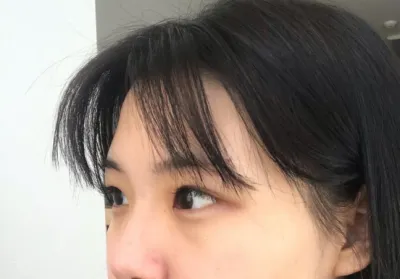 [Нүд] Унгангөнг - Давхар зовхи (байгалийн наалт), дээд зовхины зүслэг