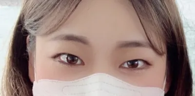 [Нүд] Дароми - Давхар зовхи (зүсэлттэй), нүдний хэлбэр засах