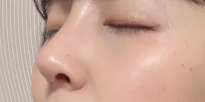 [Хамрын мэс ажилбар] Кокоринкокотуу - Хамар