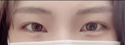 [Нүд] itxufx - Дээд зовхи засвар, Доод зовхи засвар