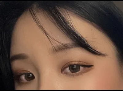 [Нүд] Ясны үр дүн - Зүсэлт