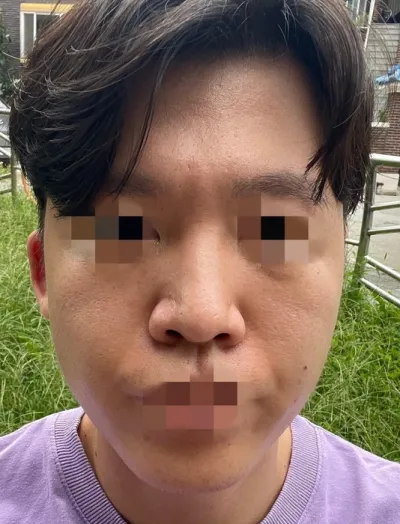 [Эрэгтэй] Жоан - Хамар, Контур