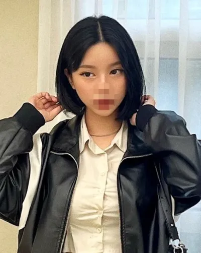 [Нүүрний хэлбэр засах мэс ажилбар] Asher - Нүүрний хэлбэр засах 2 төрлийн мэс ажилбар