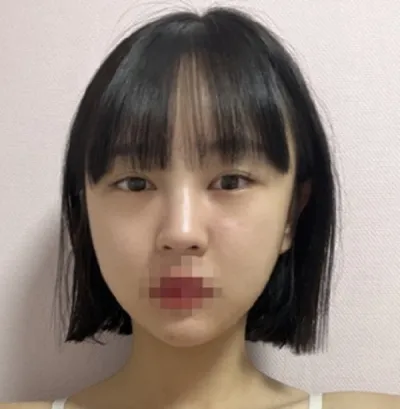 [Нүд] Дугуй нүд - Нүд