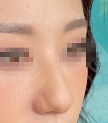 [Хамрын] Хар ирвэс - Хамар