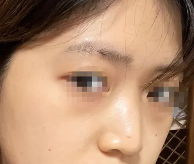 [Нүд] Сундеделла - Нүд, хамар