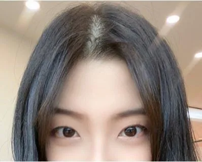 [Нүд] Эгэл жирийн - Нүд