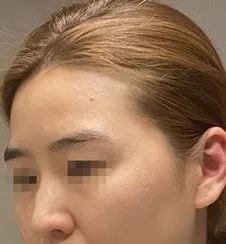 [Хамрын] Дээврийн өрөөний муур - Хамар