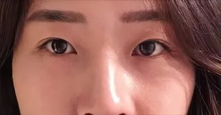 [Нүд] Доктор Жарт - Нүд