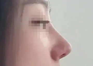 [Хамрын] Мин-жанг - Хамар