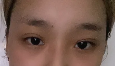 [Хамрын] Мелоди - Нүүрний хэлбэр, нүд, хамар