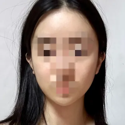 [Нүүрний контур] Минбли - Нүүрний контур