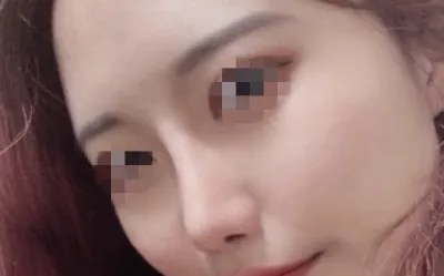 [Хамрын] Мүнмүний - Хамар