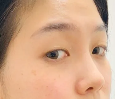 [Нүд] Гвак Минё - Нүд, Хамар