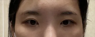 [Нүд] Бүх зүйл - Нүд