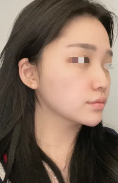 [Хамрын] Дуудумчит - Хамар