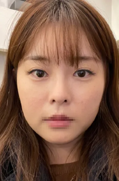 [Нүүрний контур] Хапжон кафе - Нүд, хамар, нүүрний өөх соруулах, контур