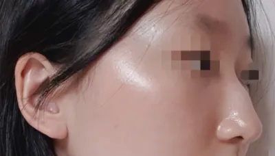 [Хамрын] Пиноккио - Хамар