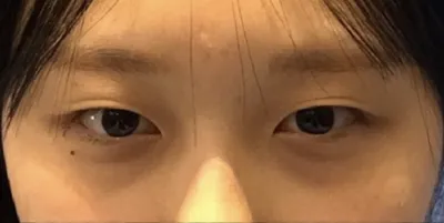 [Нүд] Өөрчлөлт - Нүд