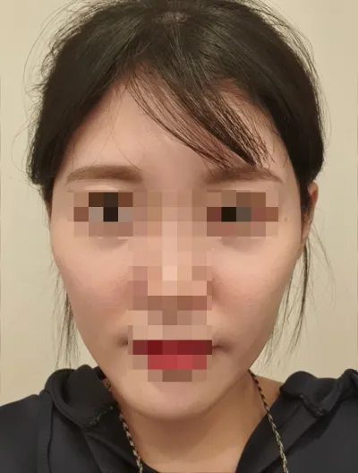 [Нүүрний контур] Чимэгтэй орны жигнэмэг - Нүүрний контур