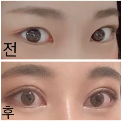 [Нүд] Хохоба - Нүд, хамар, дух өргөх