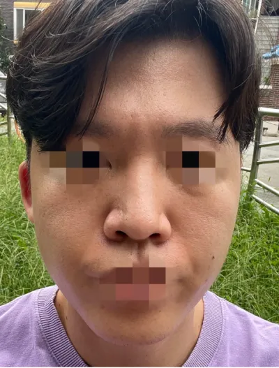 [Хамрын] Мэбул - Хамар