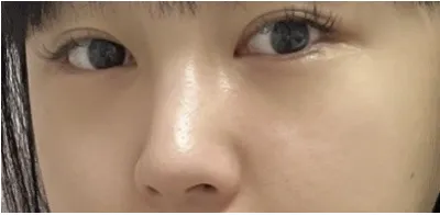 [Нүд] Улаан - Нүд, Хамар