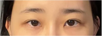 [Нүд] Юүсонмэжик - Нүд